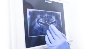 Como-se-toman-las-radiografias