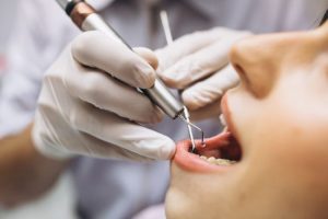 avances en odontología