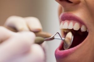 la imagen muestra un close up a la boca de una paciente mujer, siendo revisada por un odontólogo