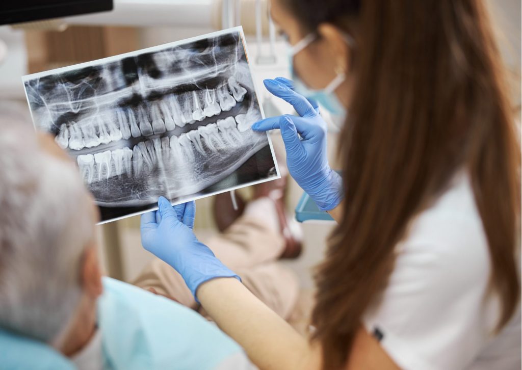 Dentista mujer sostienen entre sus manos una radiografía panorámica y muestra con uno de sus dedos enguantados una parte en la esquina inferior izquierda a un paciente de espalda a la foto. Tema: Pérdida del hueso dental. Clínica Everest