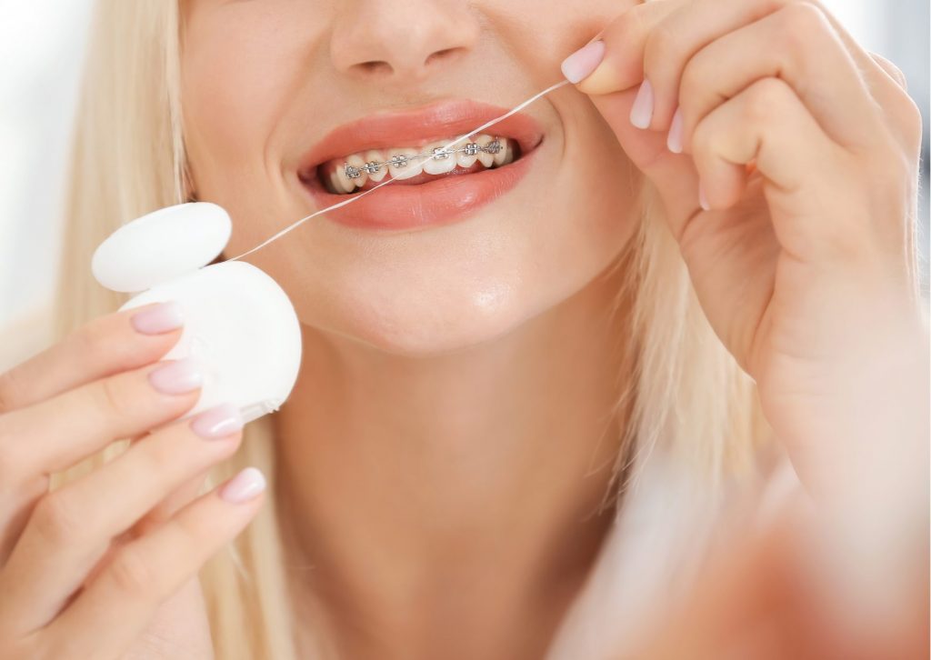Mujer de cabello rubio y liso se pasa hilo dental entre sus dientes que tienen brackets metálicos. tema: limpieza de aparatos de ortodoncia. Clínica Everest
