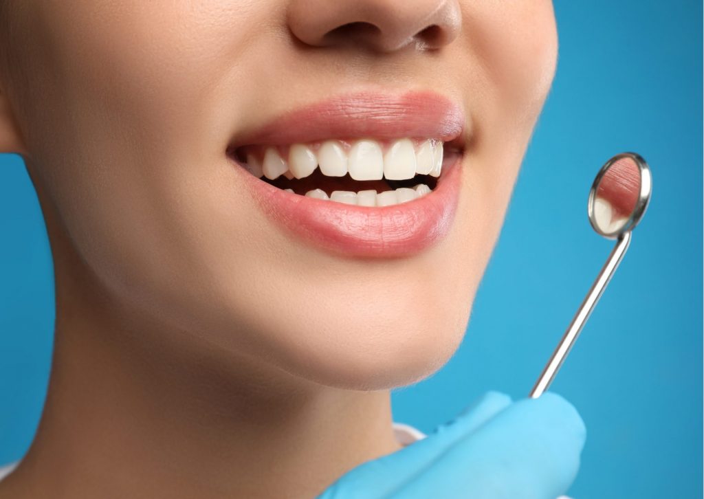 Primer plano a boca de mujer que sonríe mostrando una dentadura blanca y alineada. un mano enguantada sostiene un espejo dental. Fondo azul. Tema: hipoplasia del esmalte. Clínica Everest